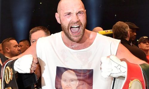 Boxing Champ Tyson Fury Kisses Gay Man To Prove He’s Not Homophobic