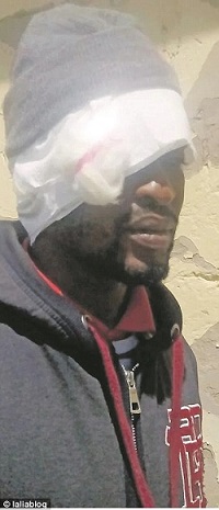 Mnombo Madyibi, 32, ended up with a bandaged head after getting intimate with his wife on their honeymoon having decided to abstain until they were wed