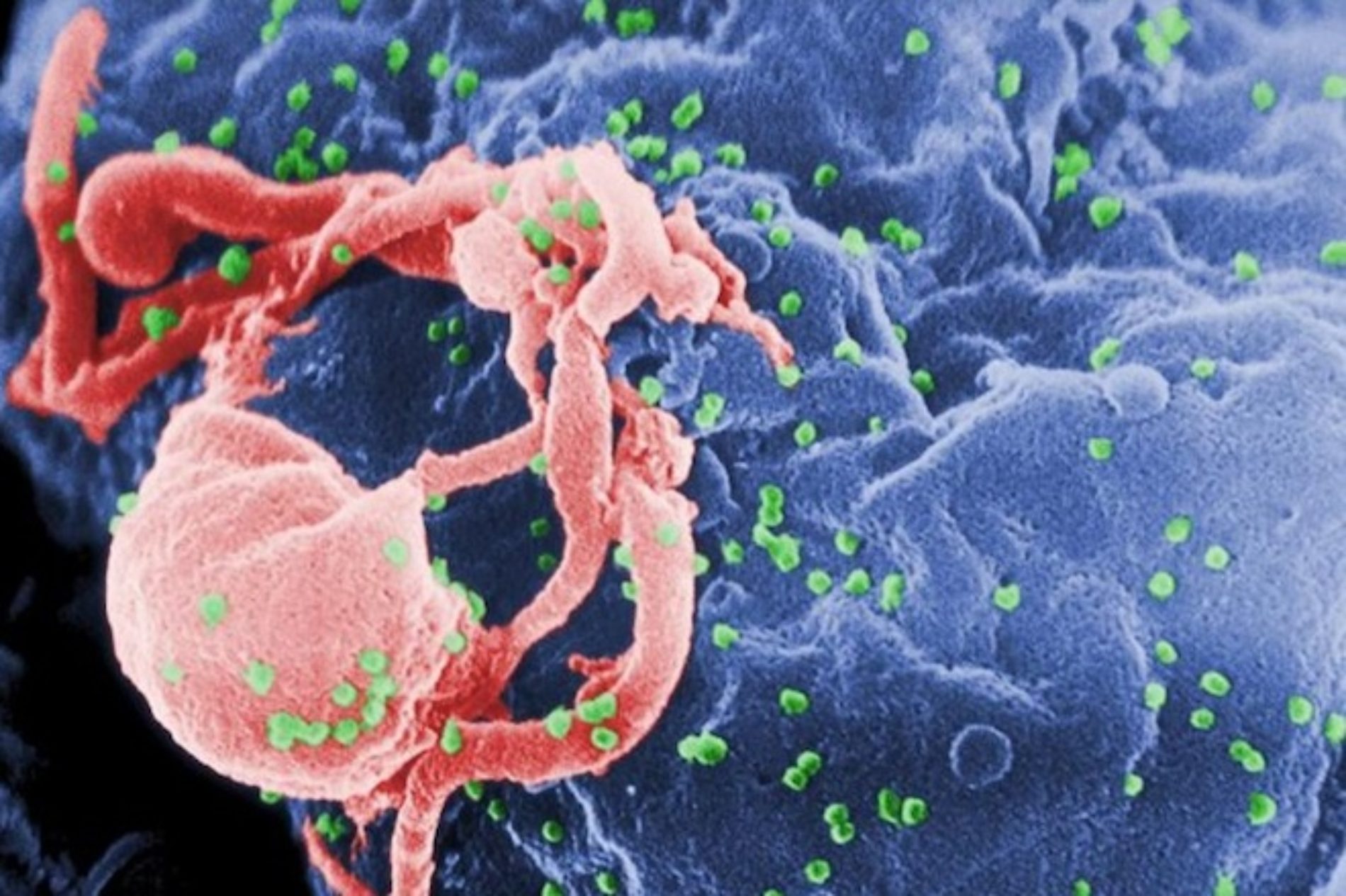 Potent New Antibody Against HIV Discovered