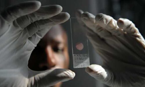 Tanzania stops health centres from providing HIV services because they ‘cater to homosexuals’