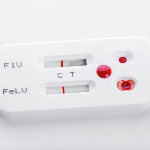 HIV Self-Test Kits Are Met With Apprehension in Kenya