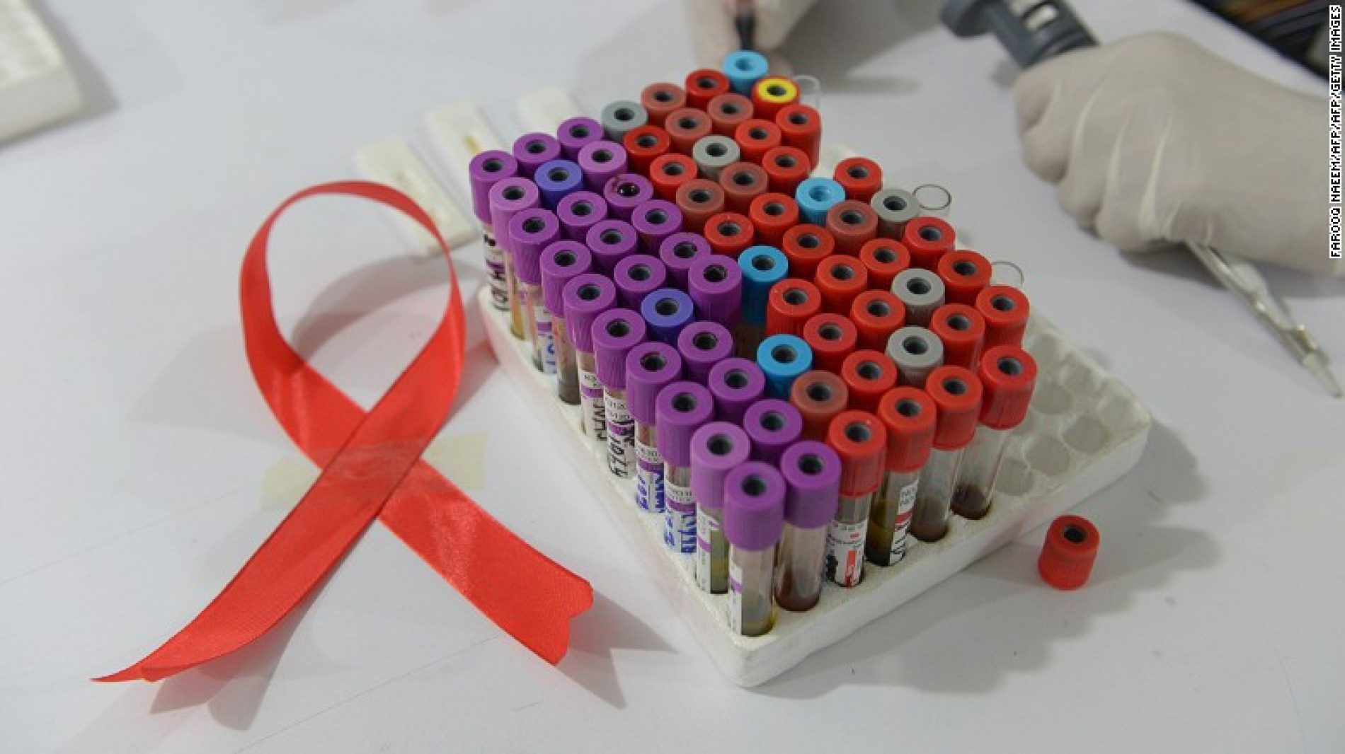 Two men might be second and third to be cured of HIV in new cases of remission from the virus